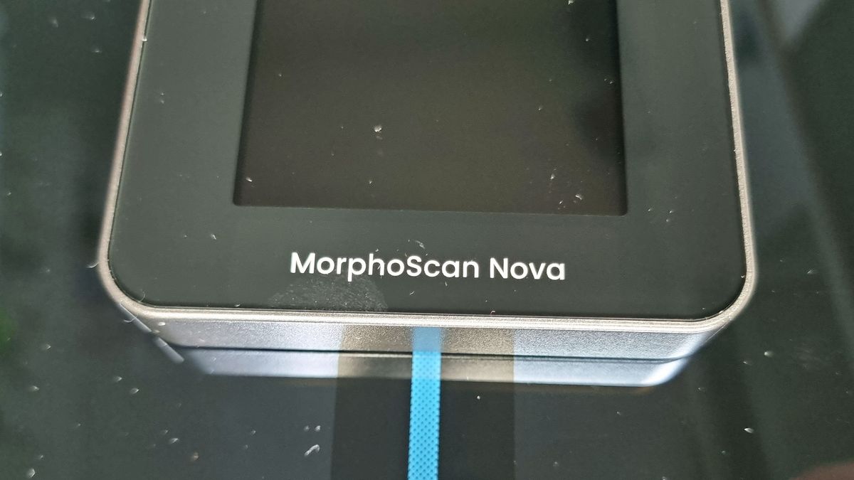 A close-up picture of the logo on the Renpho Morphoscan Nova smart scale