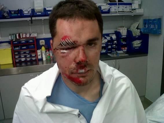 Markel Irizar was injured in a training crash in December, 2011