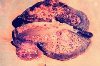 head infections, brain infections, worst ways to die, Leptospira infection in canine lungs