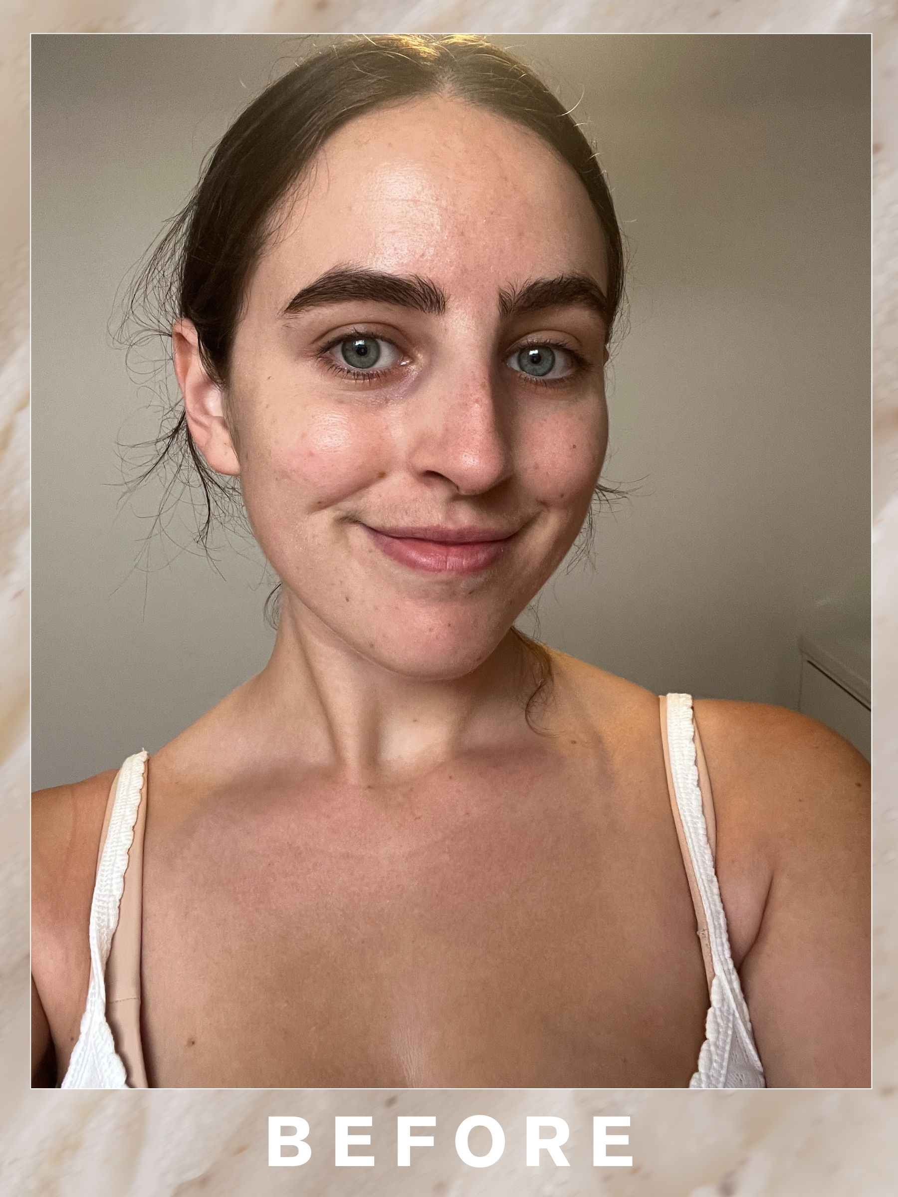 Ava after her Pfeffer Sal three sixty facial