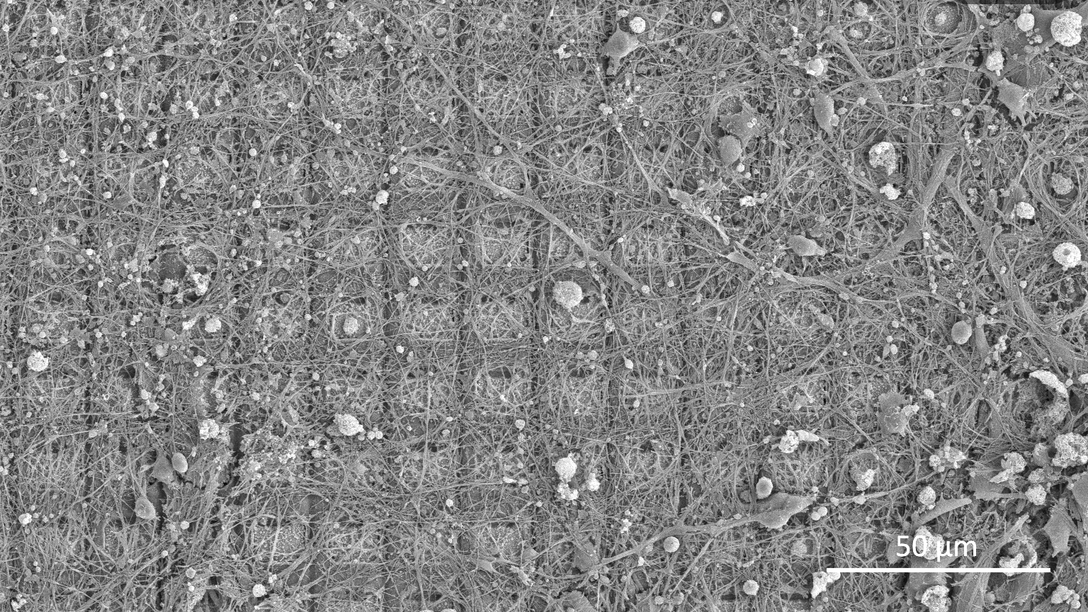 A scanning electron microscope image of the hybrid network of neurons on top of the electrode array.