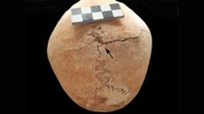 A top view of a skull with a crack in it