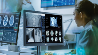 A radiologist looks on an LG display at a scan for a patient in high definition. 