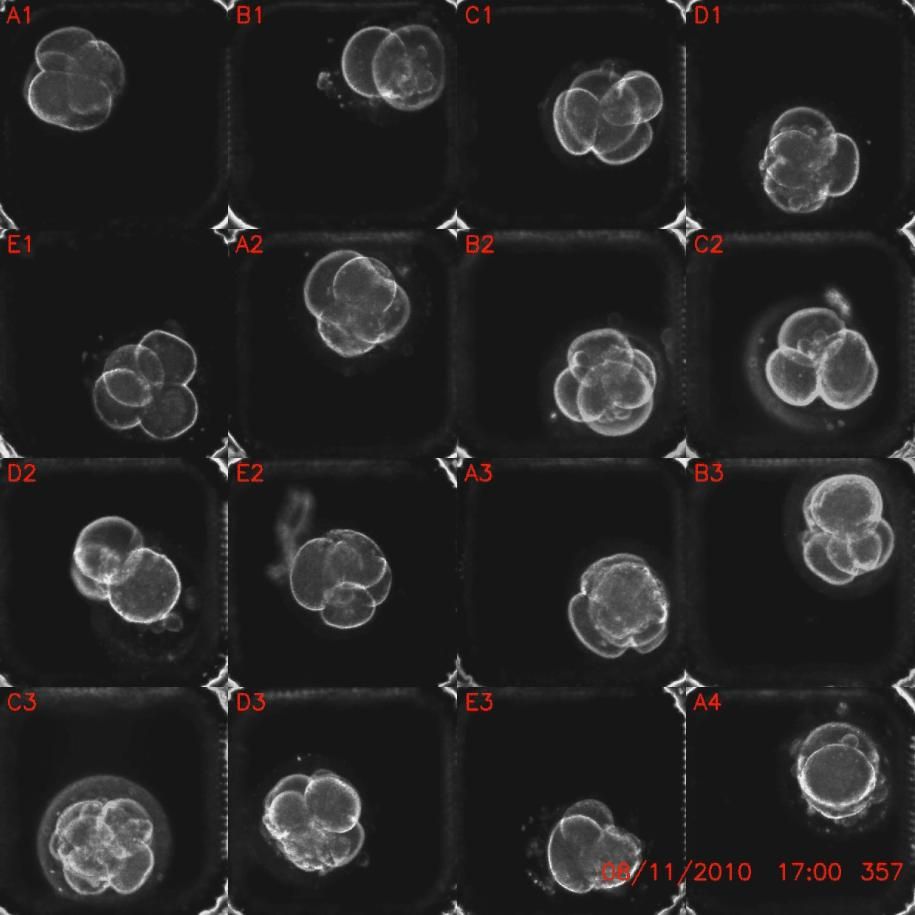 Human embryo up to day two of development.