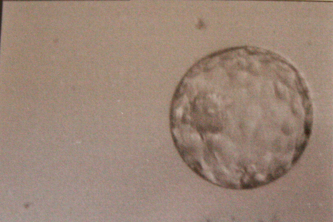 Fertilized egg, ivf