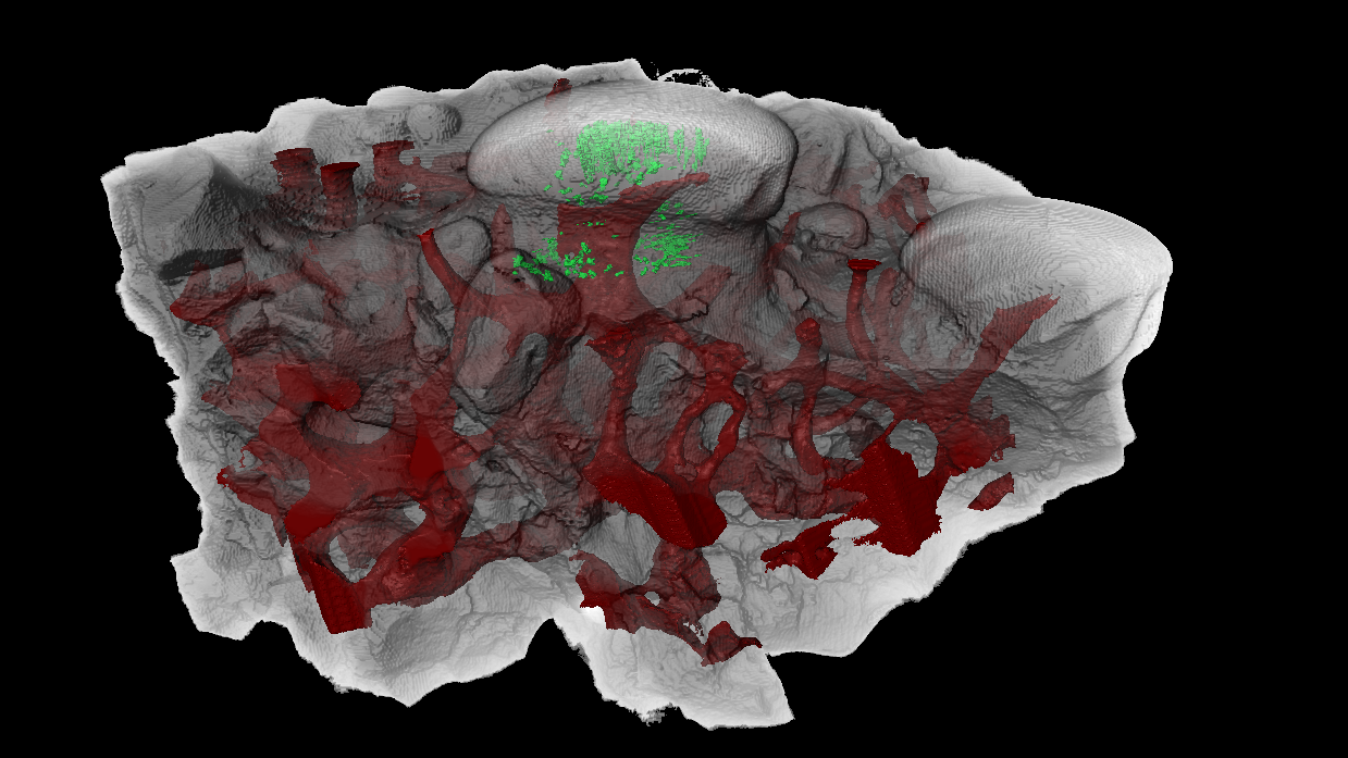 CT scan image of a tooth-like structure in an ancient jawless fish