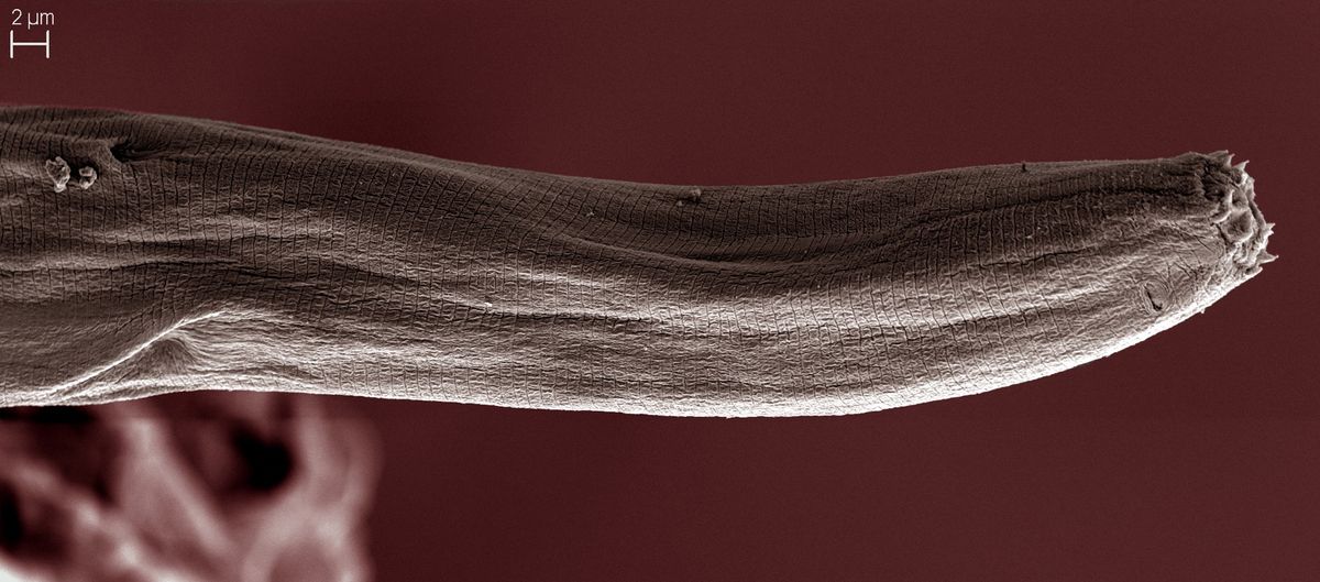 &lt;em&gt;Myolaimus ibericus&lt;/em&gt; seen under a scanning electron microscope. Species of the genus &lt;em&gt;Myolaimus&lt;/em&gt; are rare, and this worm is unusual in that it pumps sperm into the female genitalia without the penis-like spicules that are common in nematodes