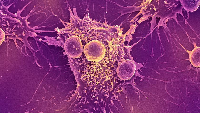 a microscope image of T cells attacking a cancer cell