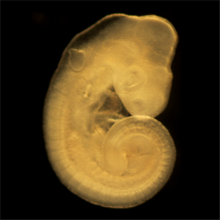 Common wall lizard embryo
