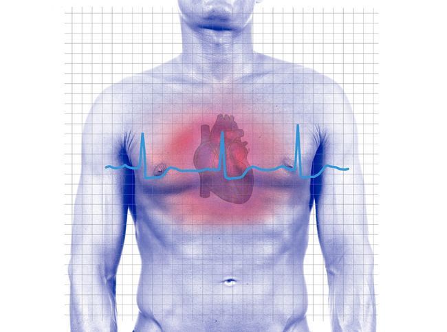 Morning Heart Attacks Are More Deadly Live Science