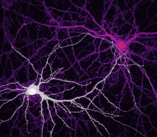 Connections between hippocampal&nbsp;neurons&nbsp;(brain cells
