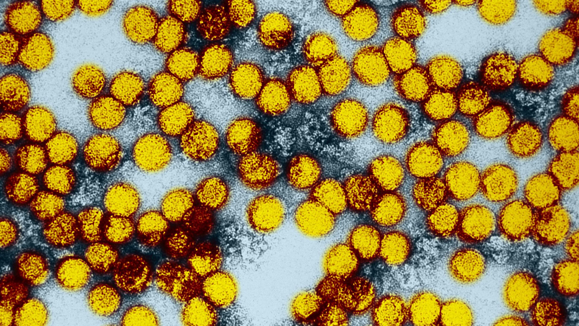 A series of yellow, spherical virus particles against a white background