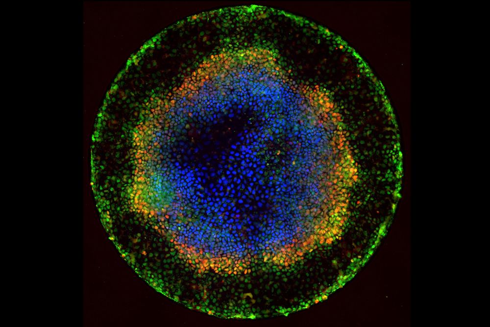 Human embryonic cells
