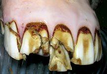 H&H_fractured_incisors-HR.jpg