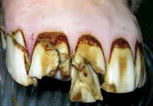 H&amp;H_fractured_incisors-HR.jpg