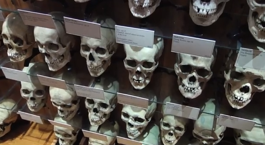 Hyrtl skull collection