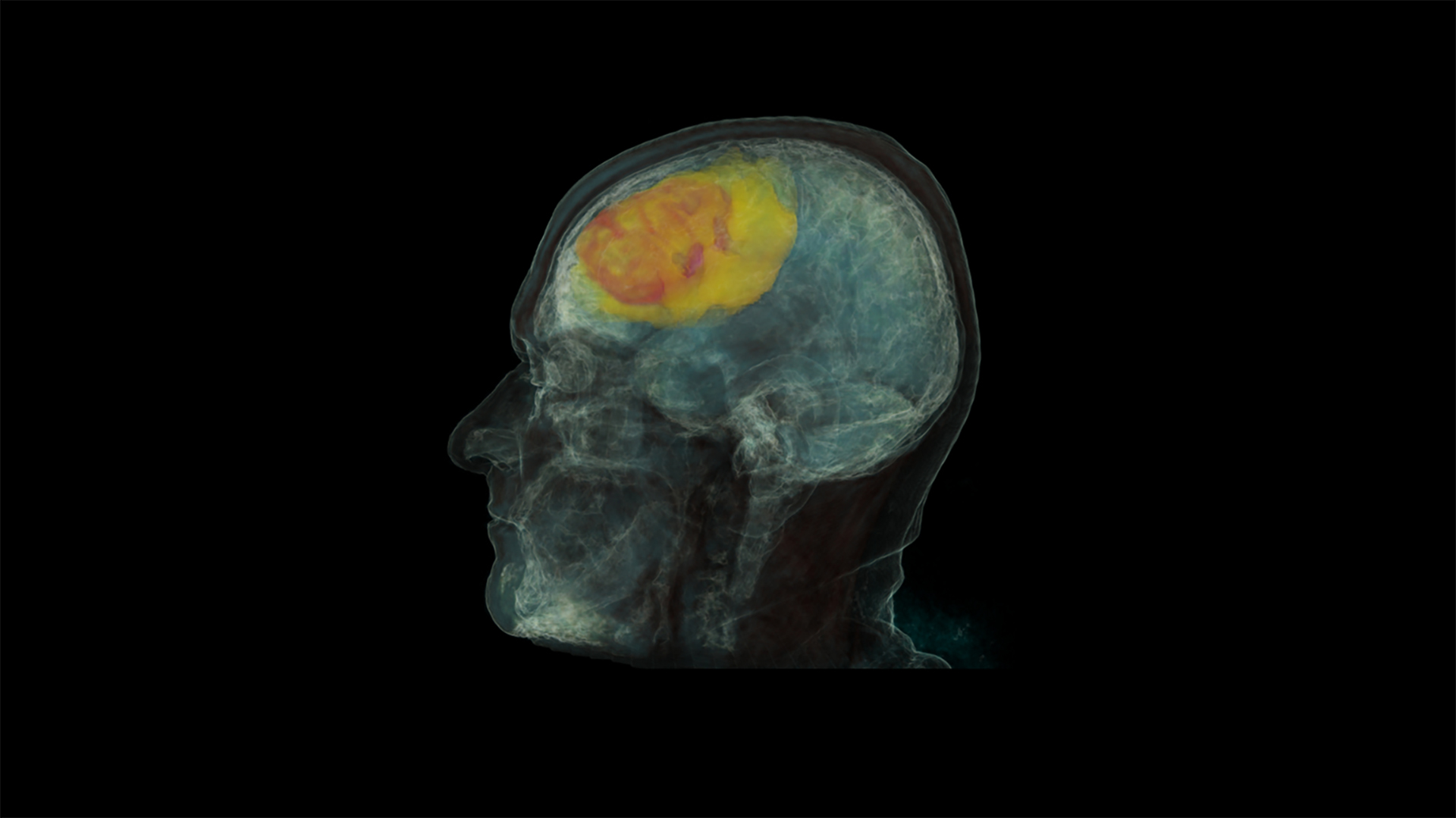 Project ImageI brain scan