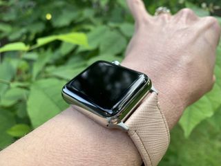 CASETiFY Apple Watch Band