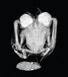  In this X-ray of the twins, the base of their shared spine can be seen branching into two. The researchers chose only to examine the twins using X-rays and an ultrasound so that the specimens could be kept intact. 