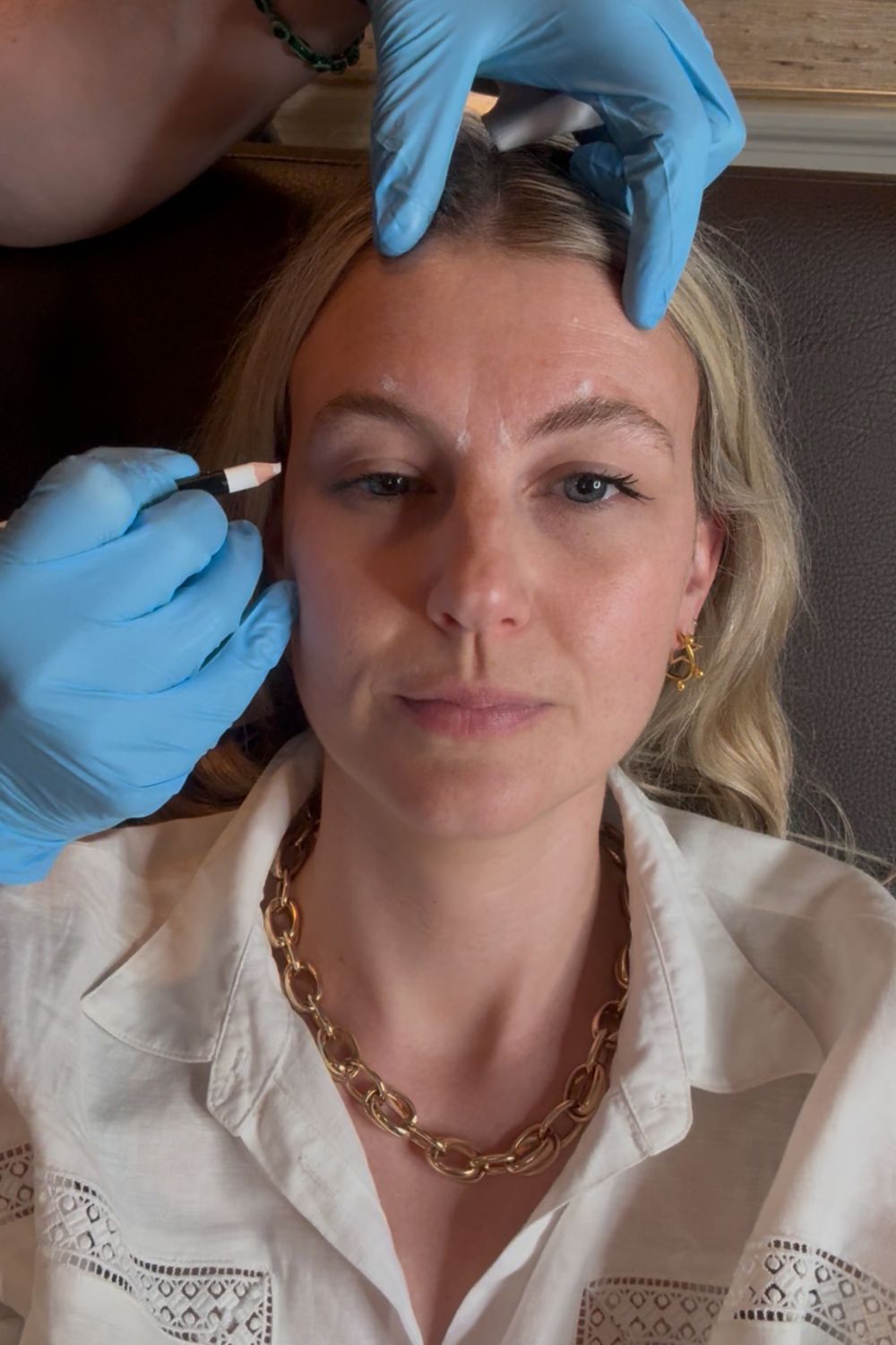 Dr David Jack identifying the areas that will be injected during a Botox treatment