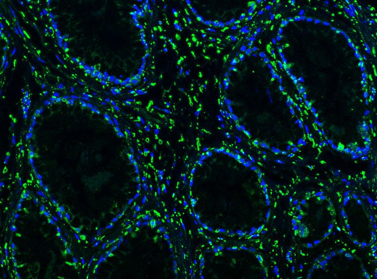 Glowing slide of IBD-infected boa constrictor kidney. 