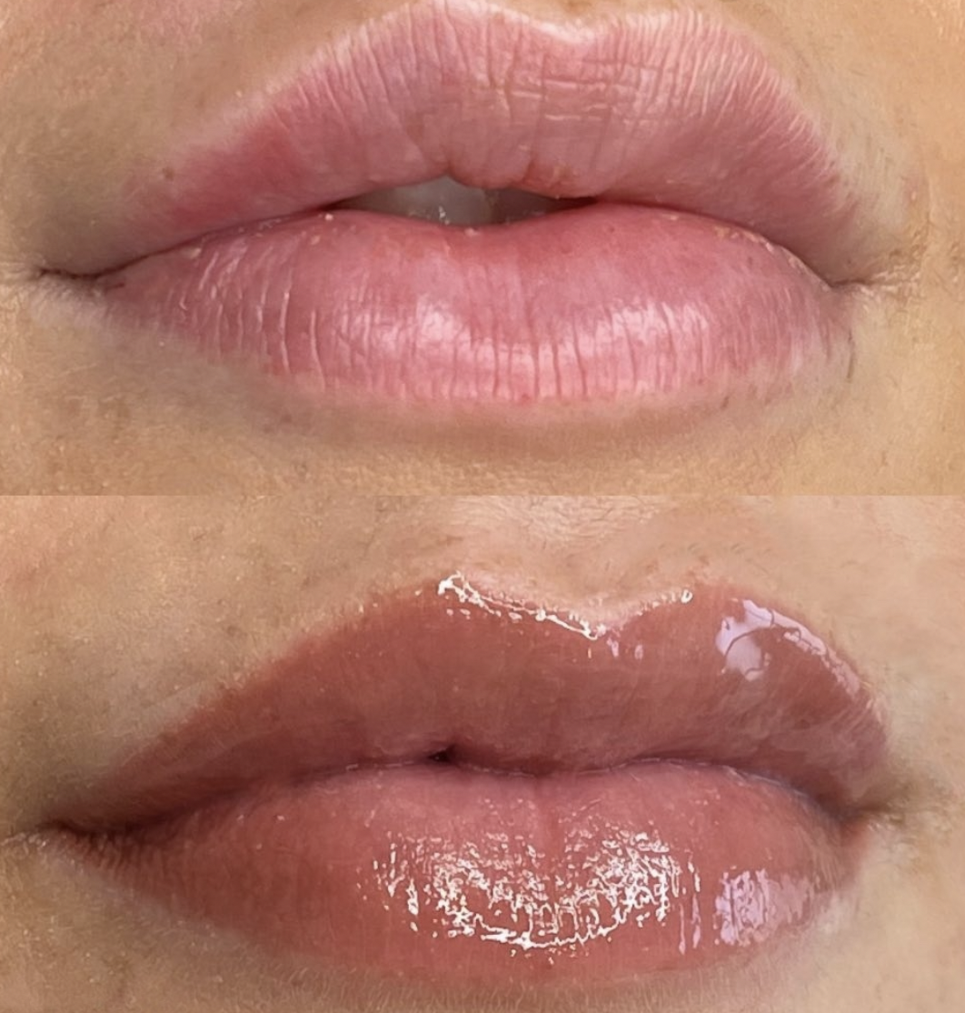 Lip Blush before and after