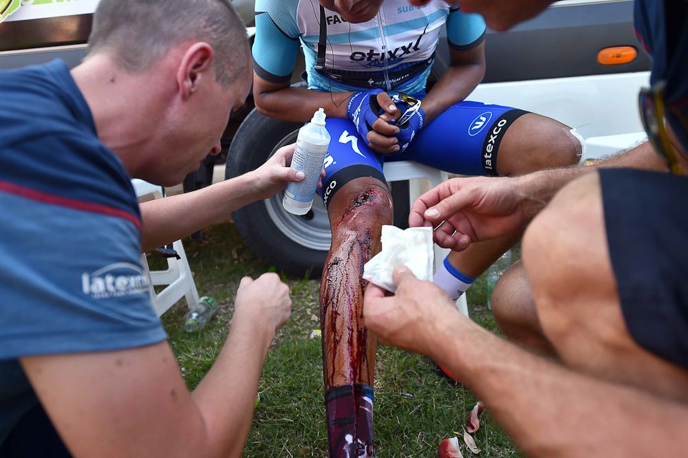 Rodrigo Contreras' knee was badly injured in the stage 5 crash.