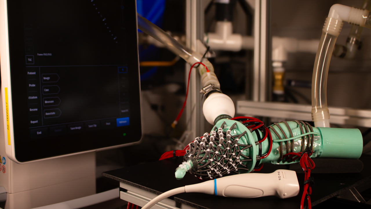 New robotic heart mimics common, mysterious condition to help researchers study it