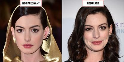 Anne Hathaway