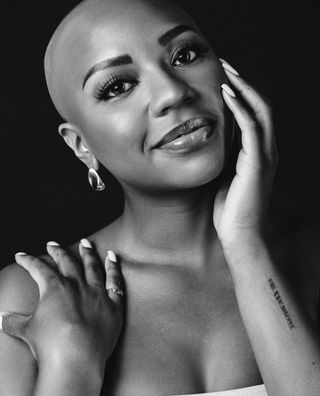 A photo of Armani Latimer posing without a wig in support of alopecia awareness.