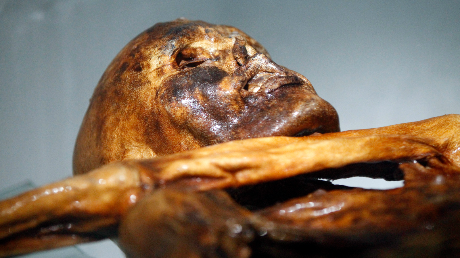 A close up of the head and arm of the mummy of an iceman named Otzi.