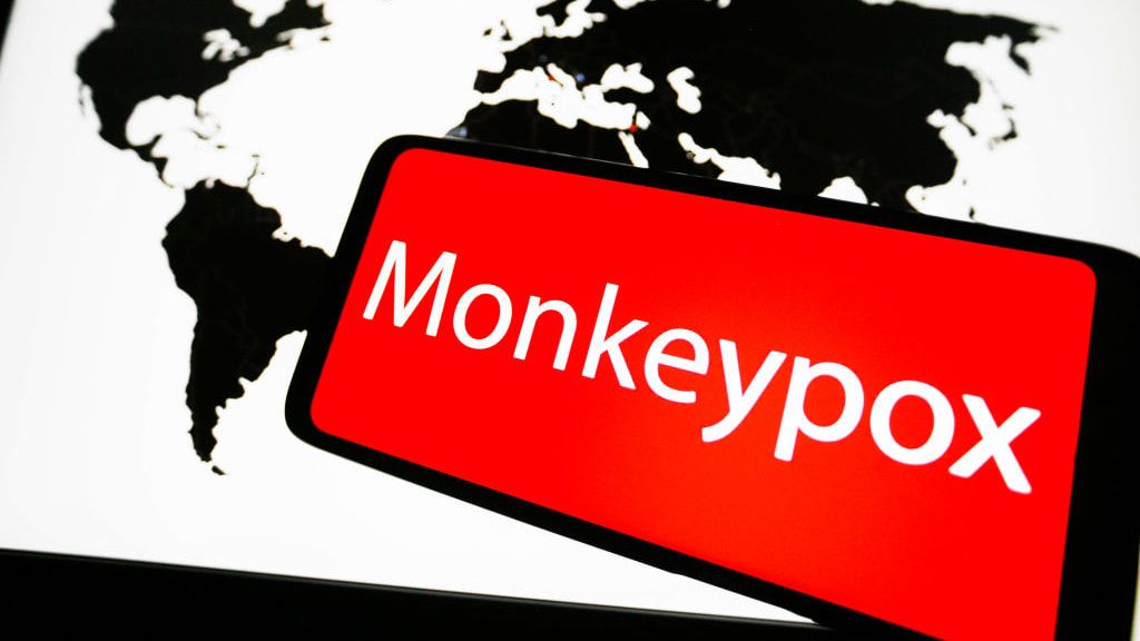 A photo illustration of a global map and the word &amp;quot;monkeypox.&amp;quot;