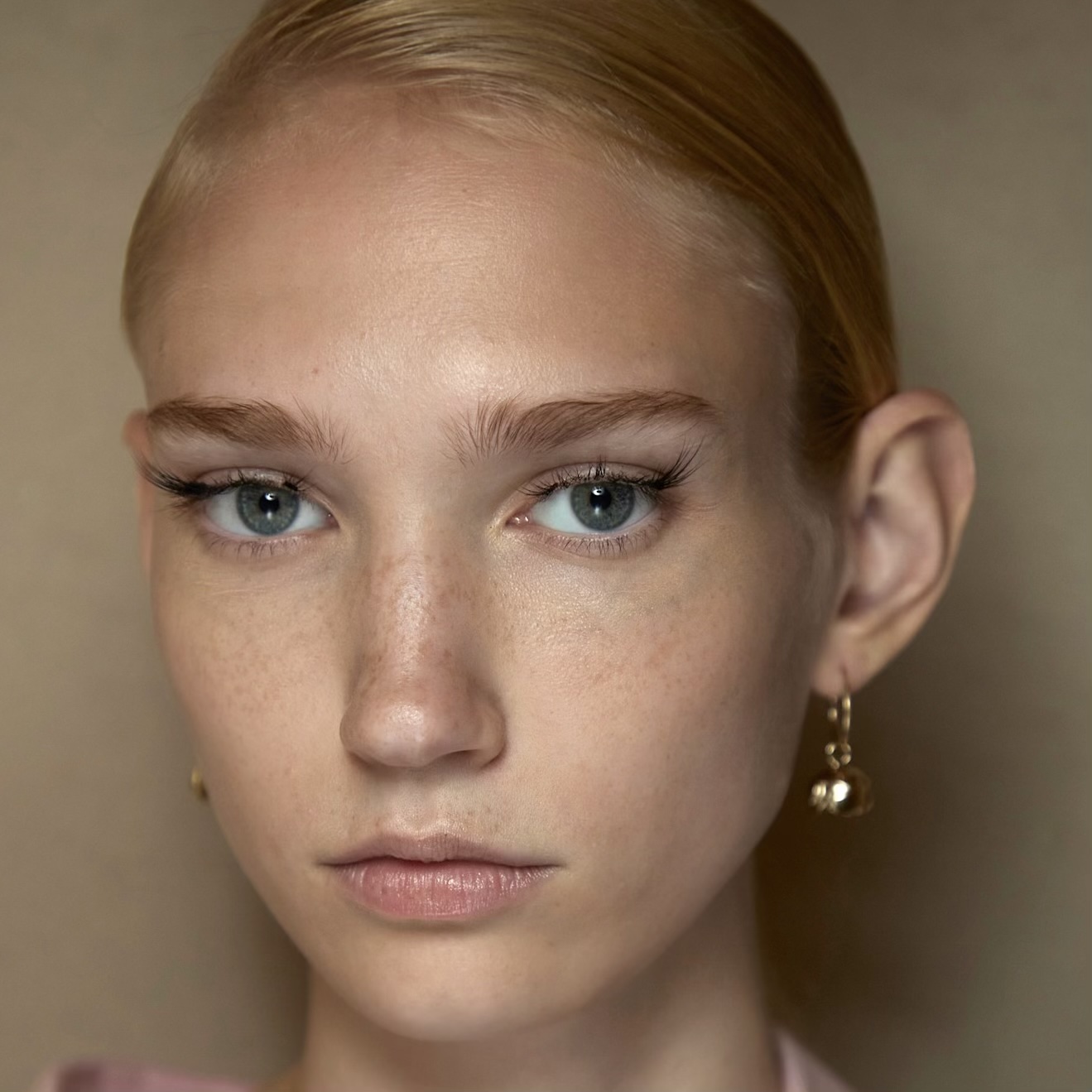 freckles on model