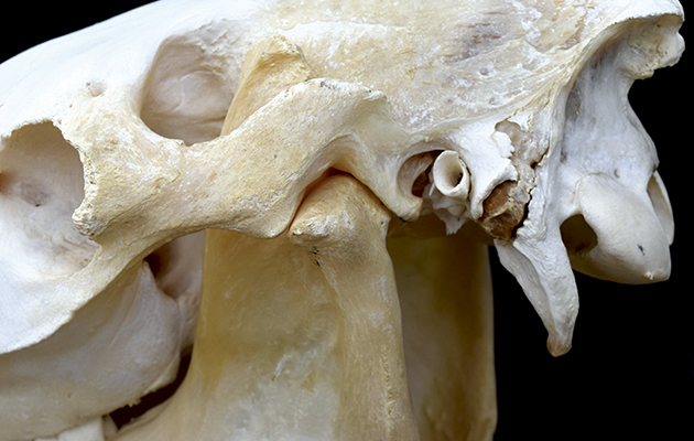 2-close-up-TMJ.jpg