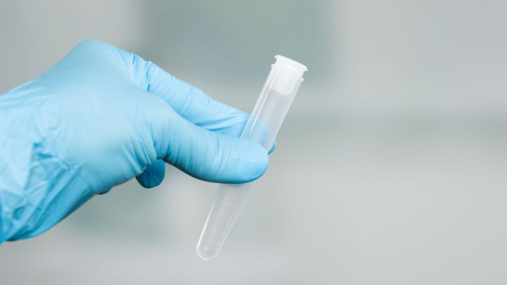 Vasectomie Procédure, risques et inversion