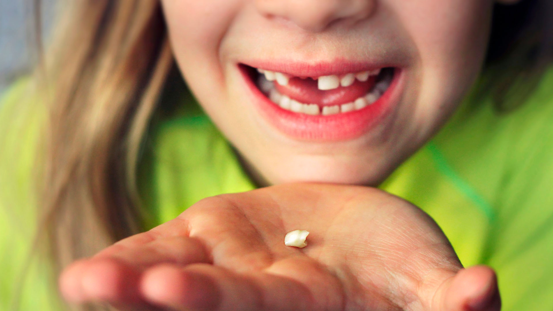 little girl who has lost a tooth