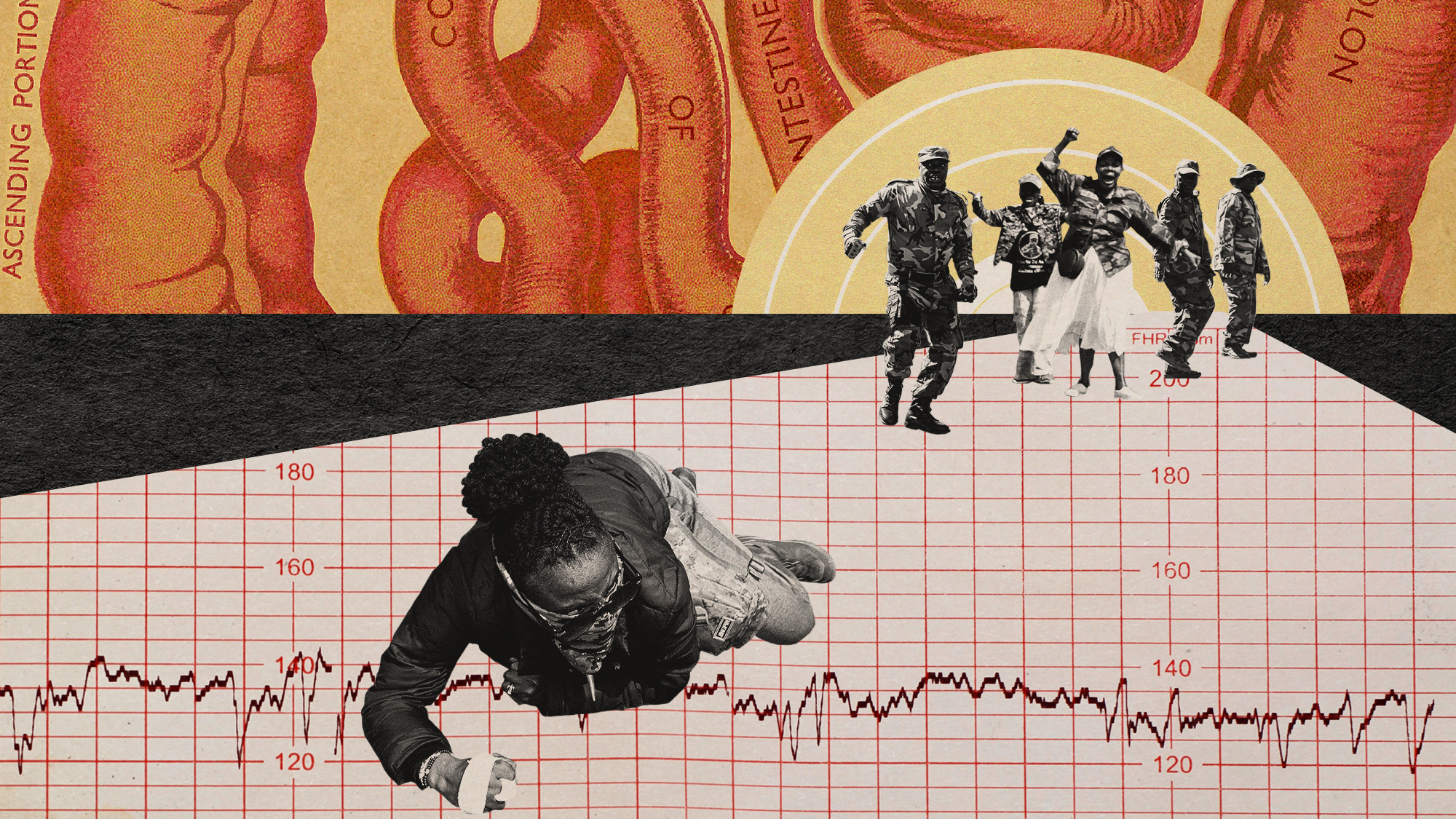 Photo collage of Operation Dudula members and supporters protesting; a woman with hand injuries is on the ground, crawling away from them. The background consists of medical illustration and an ECG printout.