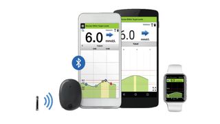 How do continuous glucose monitors work: An image showing the Senseonics EverSense CGM with a smartphone displaying blood sugar readings captured by the CGM