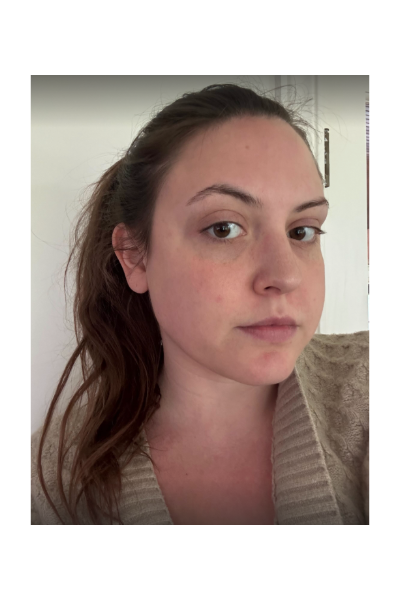 Sophia Vilensky, a 'Marie Claire' tester, tests the Sik'n 7 laser hair removal device.