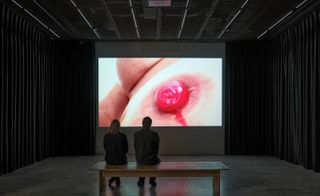 People watch Tracey Emin video of stoma on screen