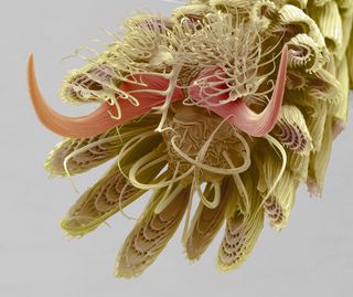 A mosquito foot magnified 800 times under a scanning electron microscope. 