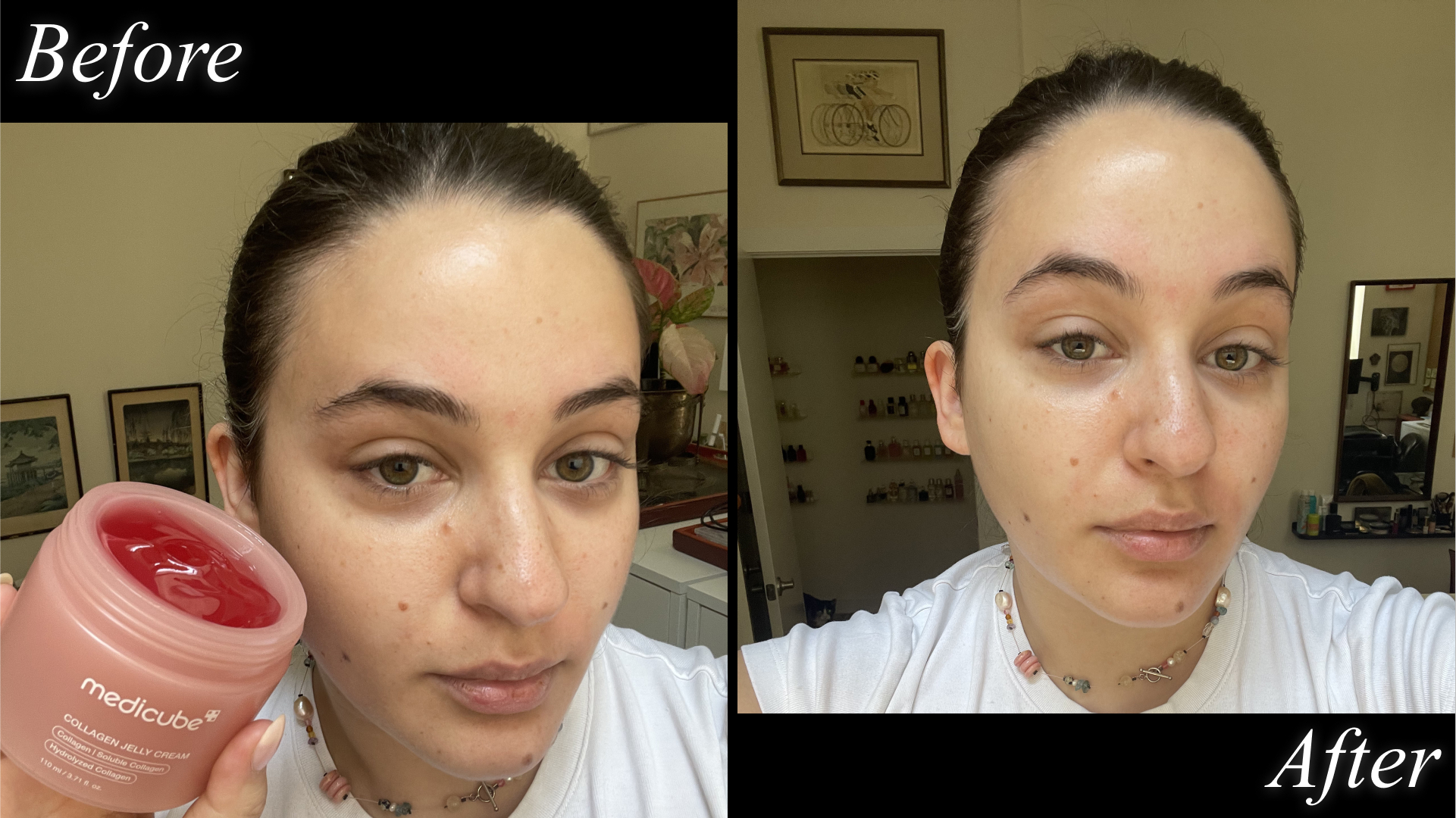 isabella sarlija before and after using the Medicube Collagen Jelly Cream.