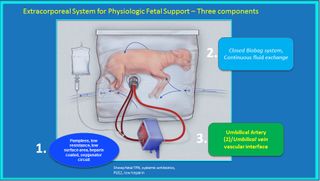 A schematic diagram of the artificial womb.