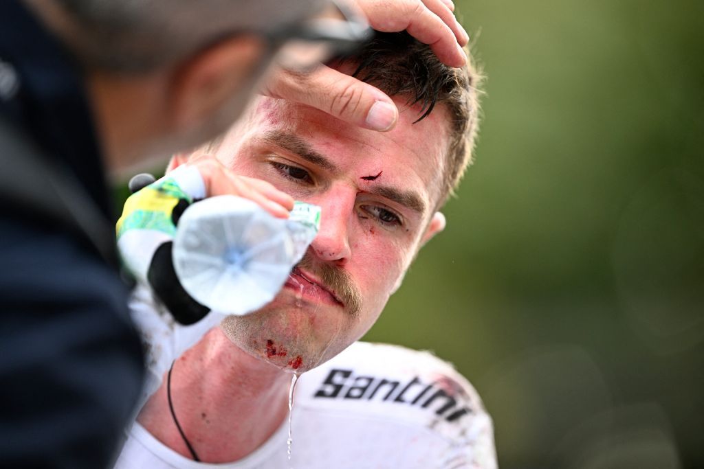 Australian Jay Vine pictured at the arrival, after a fall at the men elite individual time trial race at the 2024 UCI Road and Para-Cycling Road World Championships, Sunday 22 September 2024, in Zurich, Switzerland. The Worlds are taking place from 21 to 29 September. BELGA PHOTO JASPER JACOBS (Photo by JASPER JACOBS / BELGA MAG / Belga via AFP)