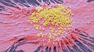 Artistic rendition of a viral pathogen with pink and yellow media.