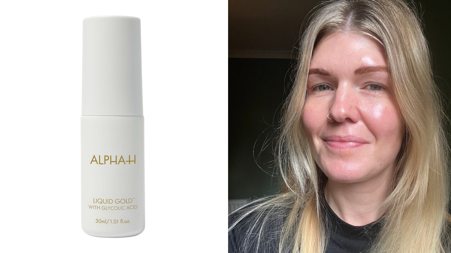 On the left, Alpha-H Liquid Gold Exfoliating Treatment with 5% Glycolic Acid and on the right, an image of Fiona McKim with makeup-free skin