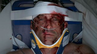 Derek Shepherd is shown with severe injuries in Grey's Anatomy Season 11 