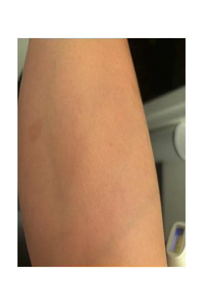 Olivia M., a ‘Marie Claire’ tester, tests the Rose Skin Co. Lumi IPL Permanent Hair Removal Device