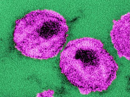 HIV, or Human Immunodeficiency Virus particles, in purple, cause the disease AIDS.