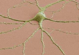 SEM of neuron